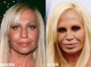 Donatella-Versace-Plastic-Surgery.jpg