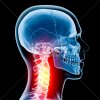 stock-photo-13265963-neck-in-pain-x-ray.jpg