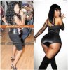 Photo-of-Nicki-Minaj-Before-and-After-Bum-Surgery-293x300.jpg