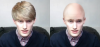 bald.PNG