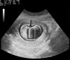 pumpkin_spice_fetus.jpg